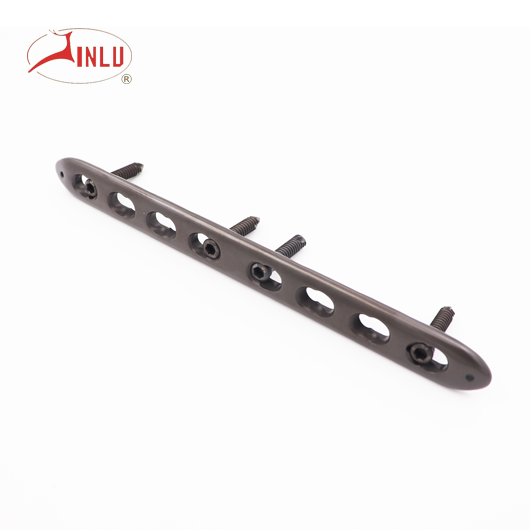 nẹp khoá đa hướng cánh tay 4